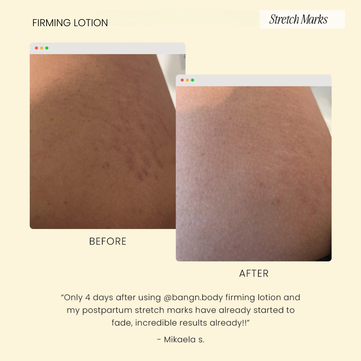 Firming Lotion