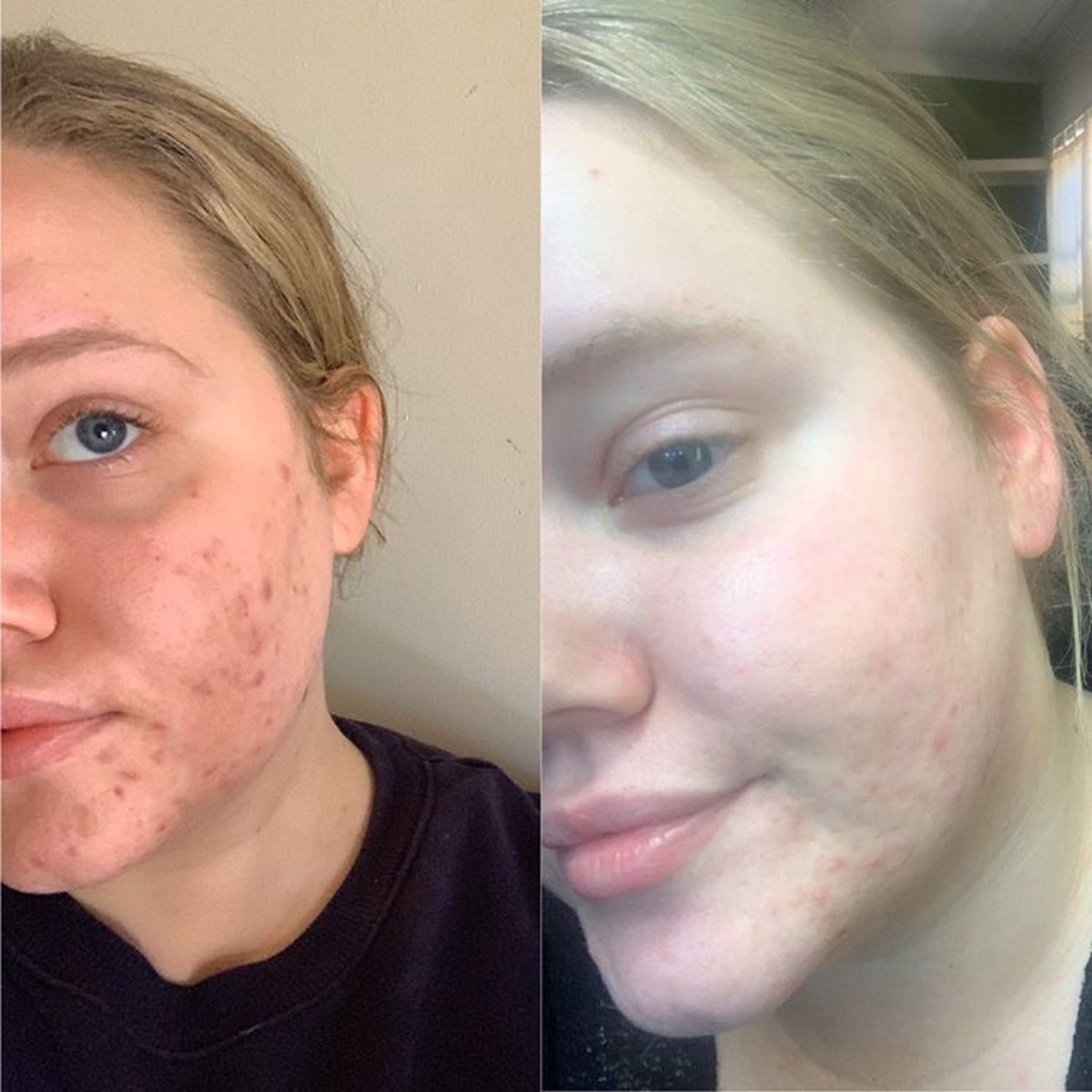 Firming & Brightening Beauty Treatment