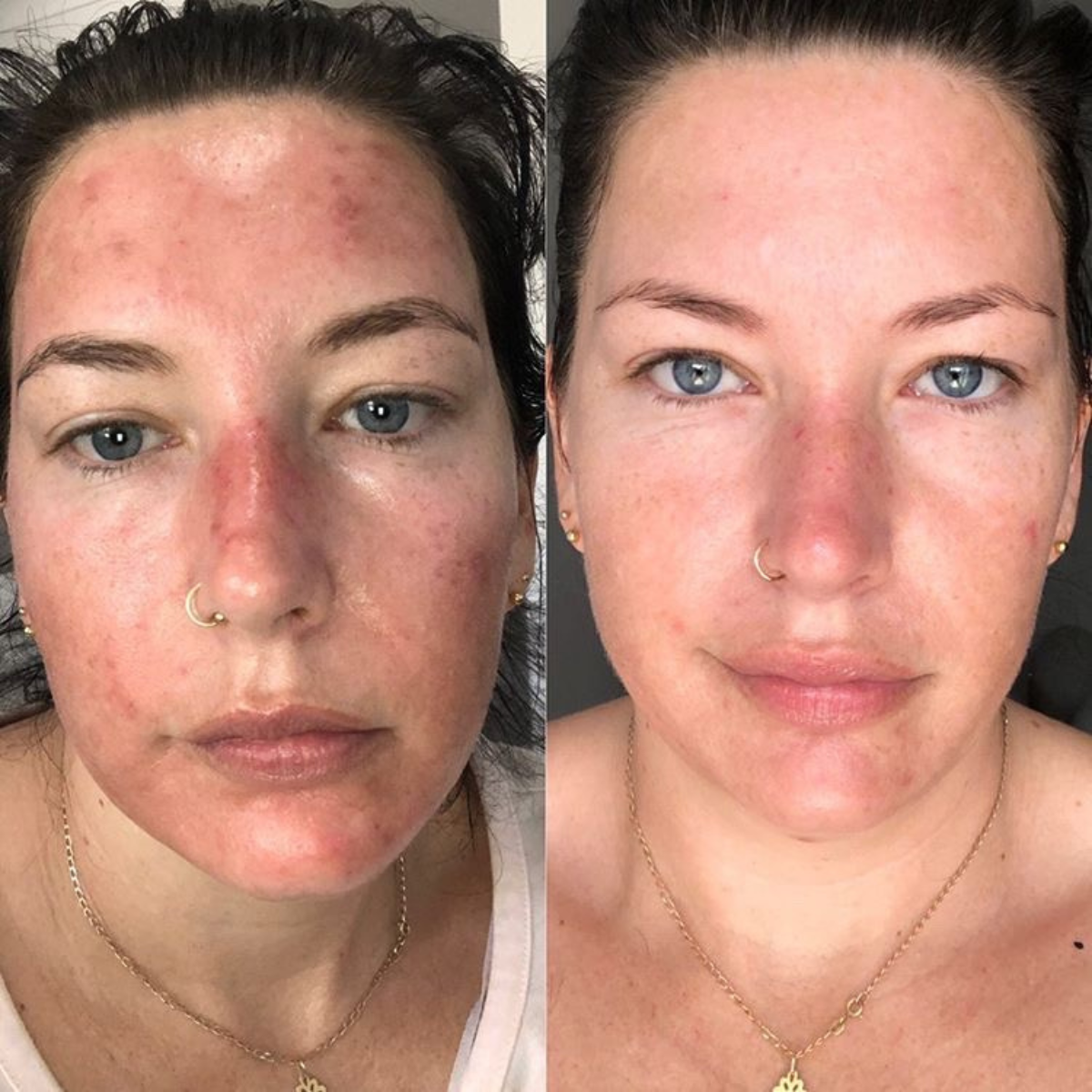 Firming & Brightening Beauty Treatment