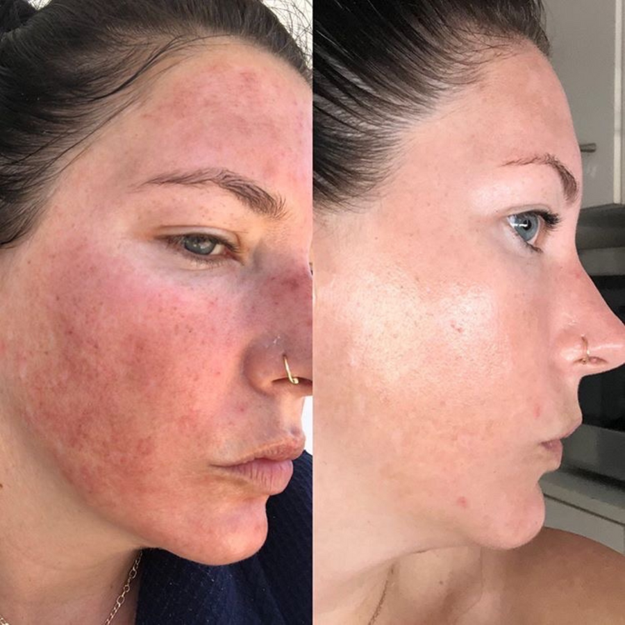 Firming & Brightening Beauty Treatment