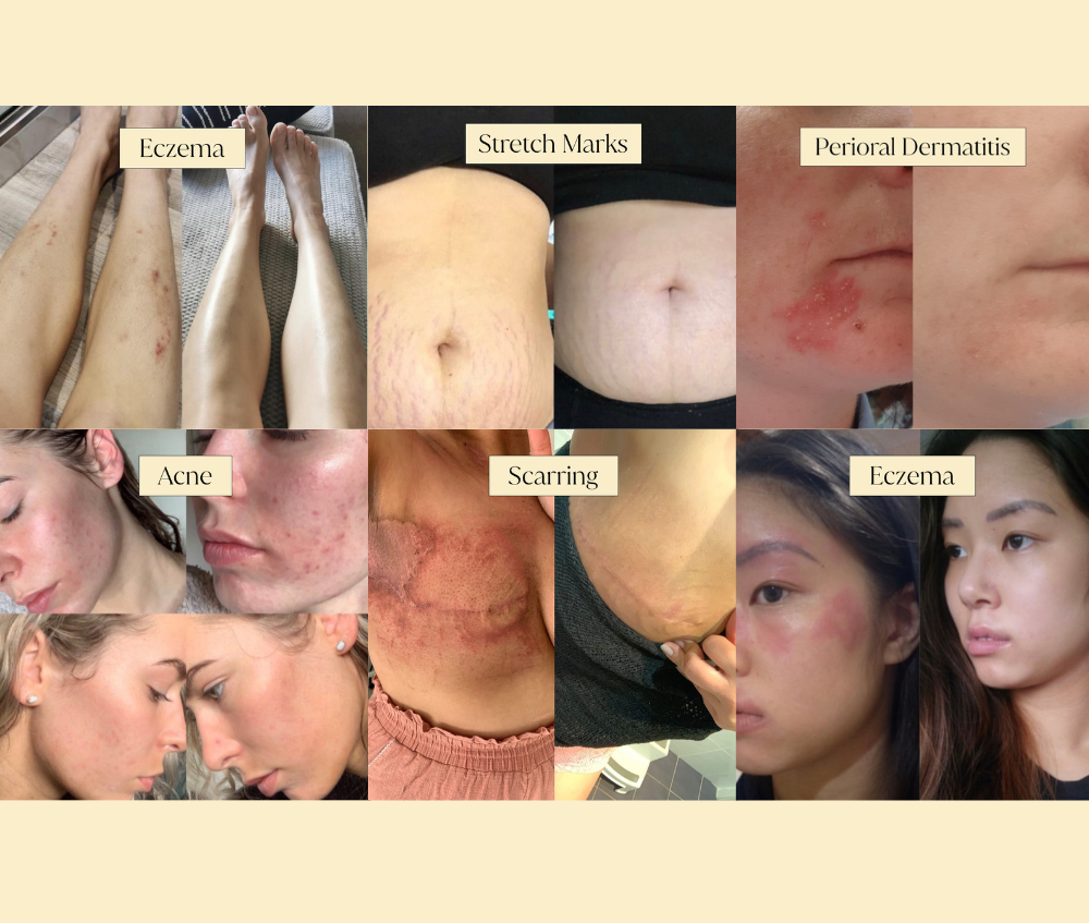 Why A Simple Skincare Routine Will Save You Time and Money