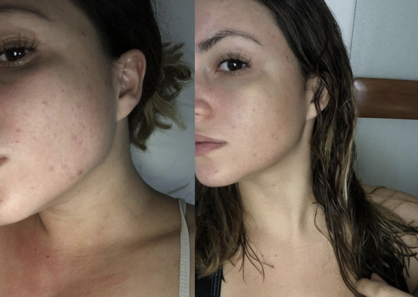 1 Day Face Results