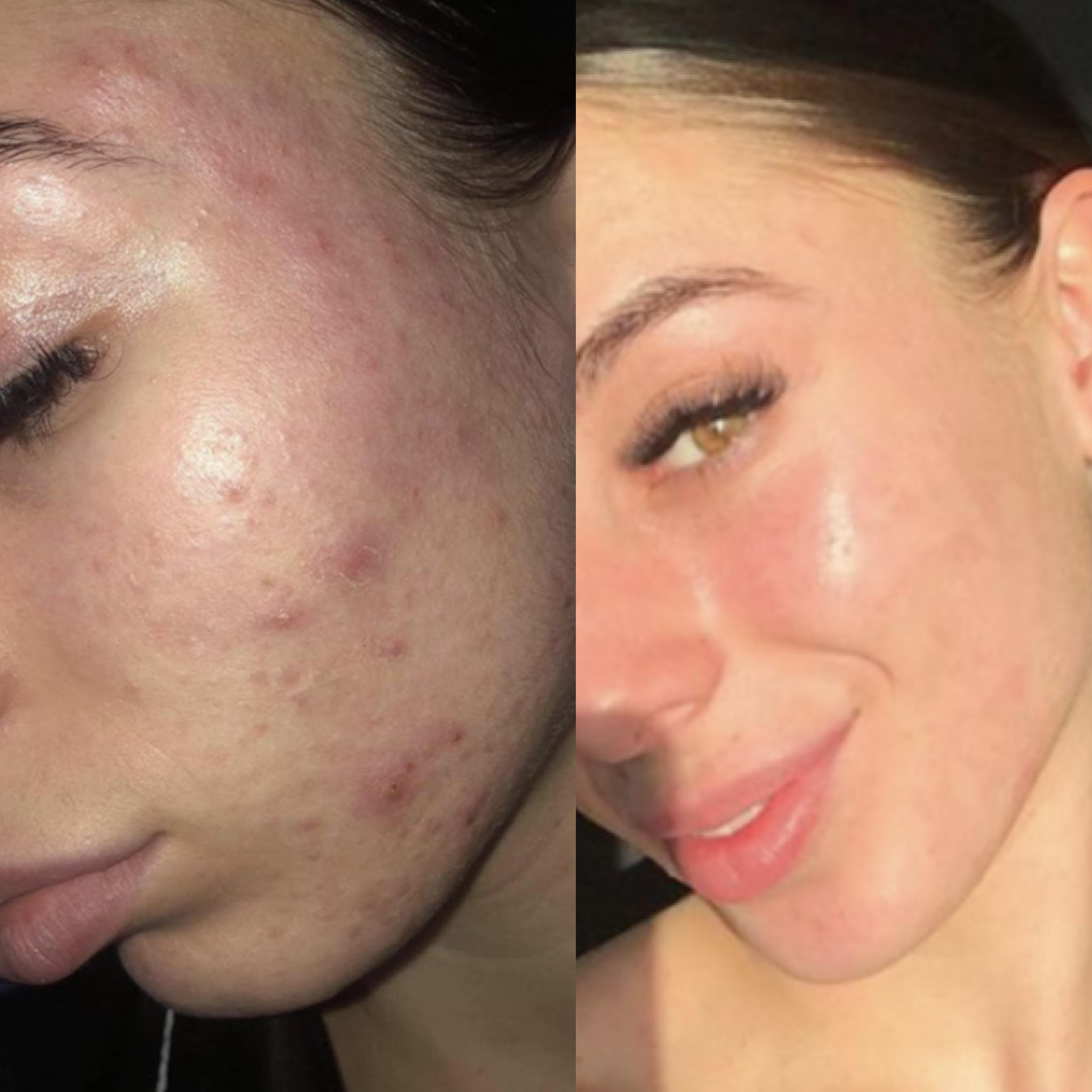 1 Week Results!